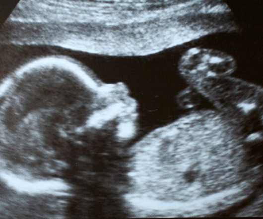 article thumbnail